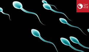 Xét nghiệm vô sinh nam: xét nghiệm mật độ tinh trùng